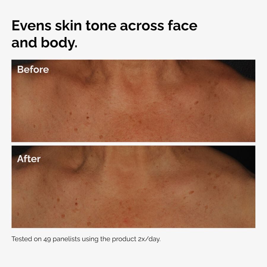 the-body-care-collection-v3 ord-niacinamide-face-body-serum-before-after-even-tone-graphic.jpg